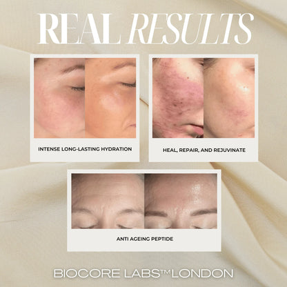 ADVANCED 3 IN 1 SUPER SERUM by BIOCORE LABS™ 100 mL 3.38 FL. OZ. - 3 IN 1 SUPER SERUM BY BIOCORE LABS 